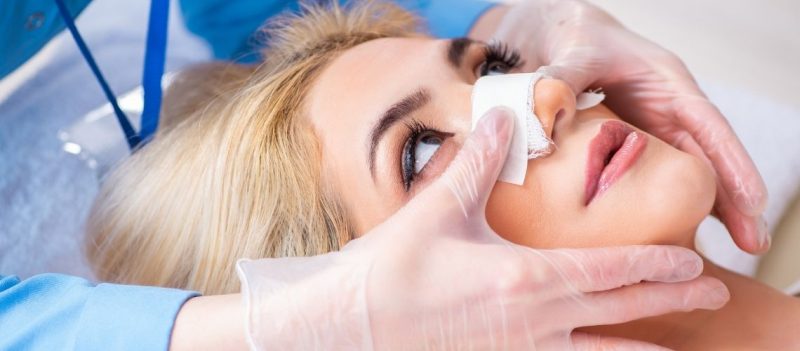 Rhinoplasty Recovery Timeline: How Long Does a Nose Job Take to Heal?