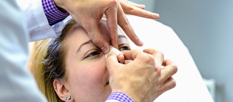 How to Reduce Surgical Stitch Scars: Treatment and Scar Care Tips