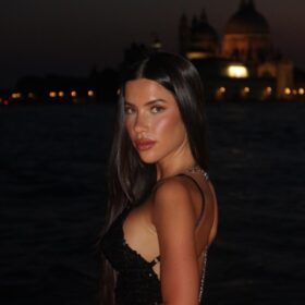 Female Rhinoplasty Result at 10 Months